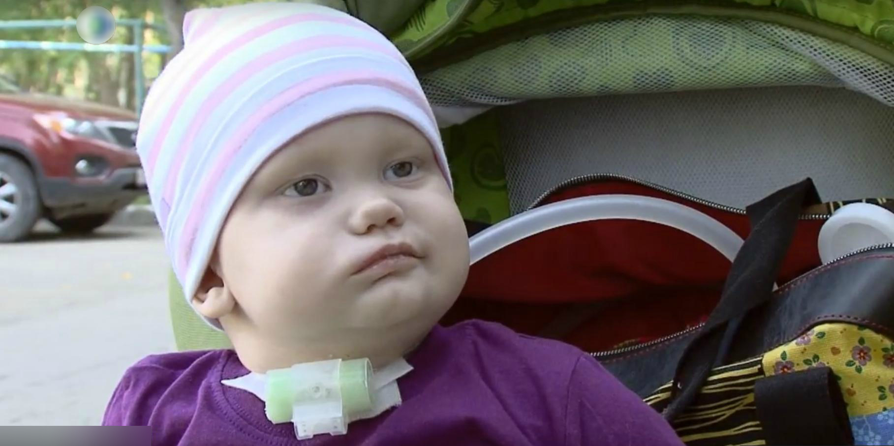 Жители Коми могут спасти маленькую девочку с опухолью мозга (видео)