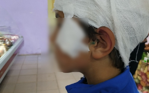 В Коми дворовая собака укусила 7-летнего ребенка за голову (фото)