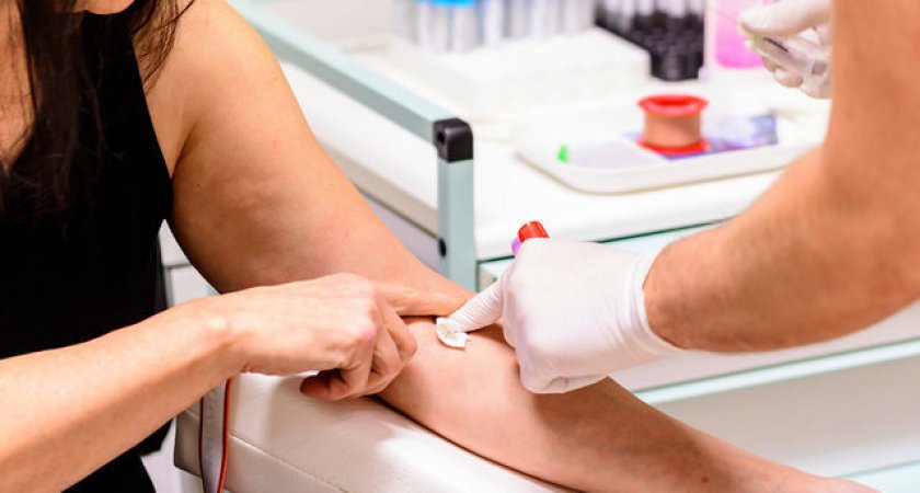 Заболеваемость ВИЧ в Коми выросла на 31%