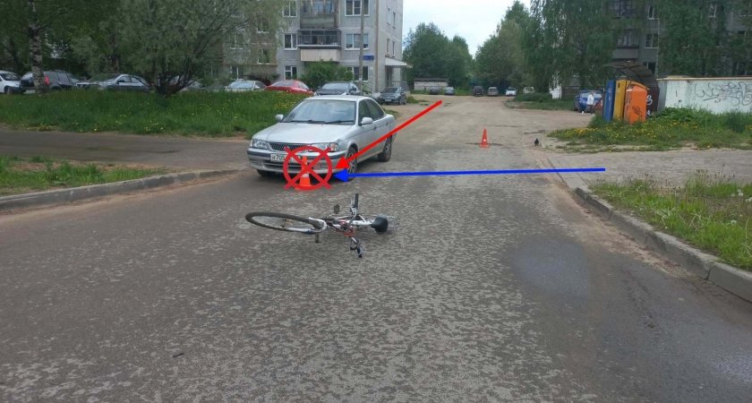 В Сыктывкаре водитель сбил пожилую велосипедистку