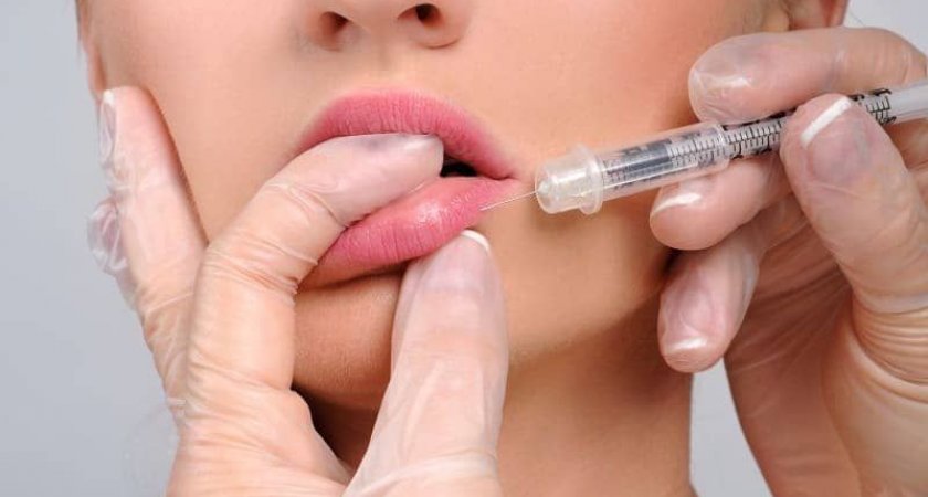 Сыктывкарка решила увеличить губы, но чуть не умерла в кресле косметолога