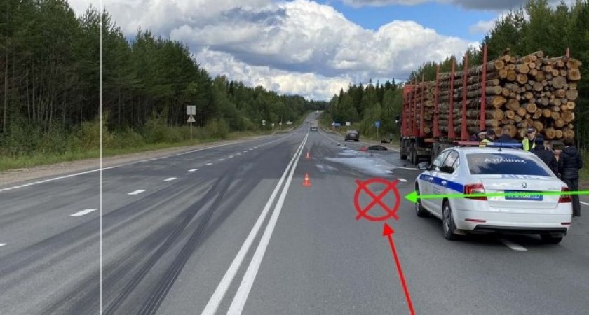 В Сыктывкаре мужчина выбежал на дорогу и погиб под колесами автомобиля