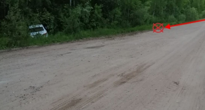 Жительница Коми попала в аварию и обожгла руки