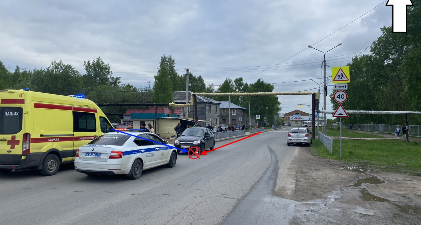 В Сыктывкаре 6-летний ребенок на велосипеде попал под колеса авто