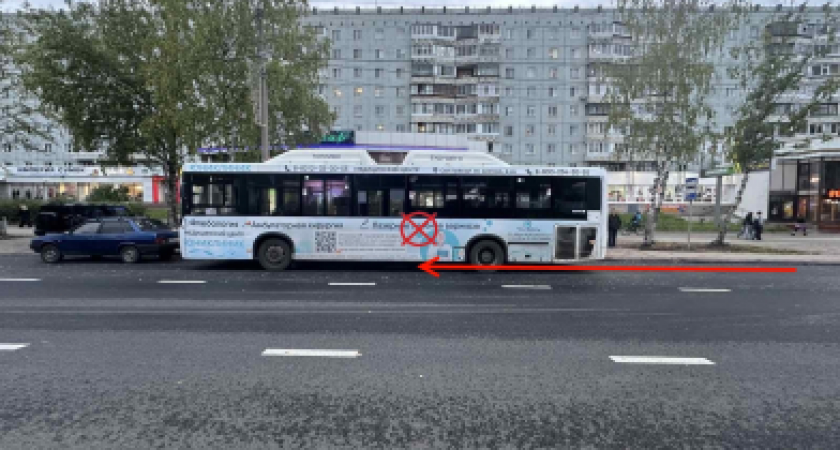 В Сыктывкаре резкая остановка автобуса стала причиной травмы у местной жительницы