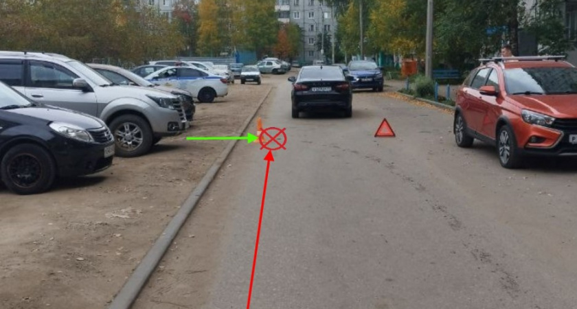 В Сыктывкаре девочка выбежала на дорогу и попала под машину