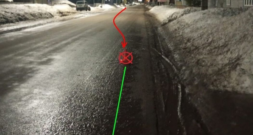 В Коми авто сбило ребенка: виновник аварии заплатит 250 тысяч рублей