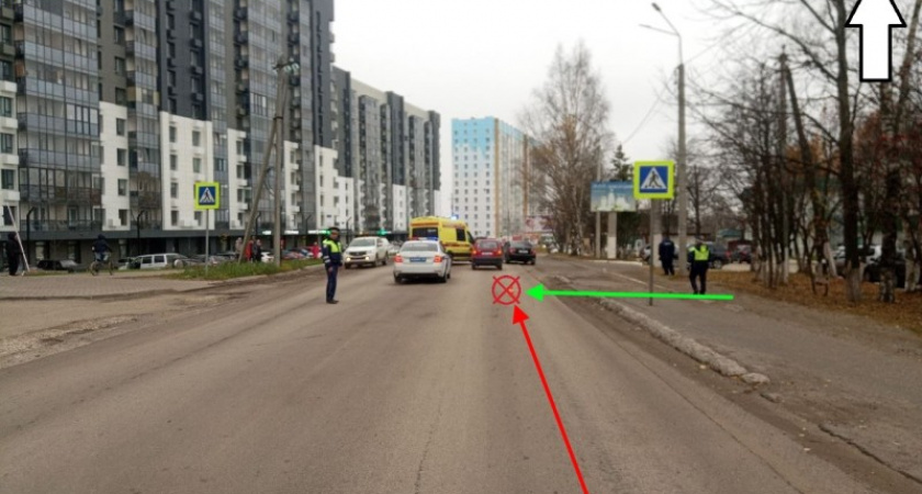 В Сыктывкаре водитель Daewoo сбила пенсионерку на пешеходном переходе: женщина в тяжелом состоянии