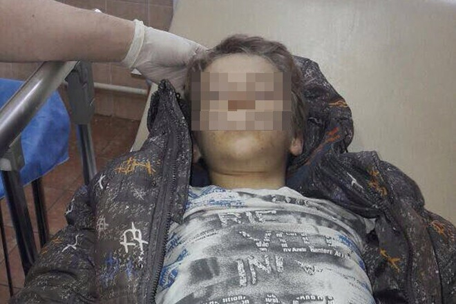 Паника в соцсетях: в Сыктывкаре в больницу попал мальчик без сознания