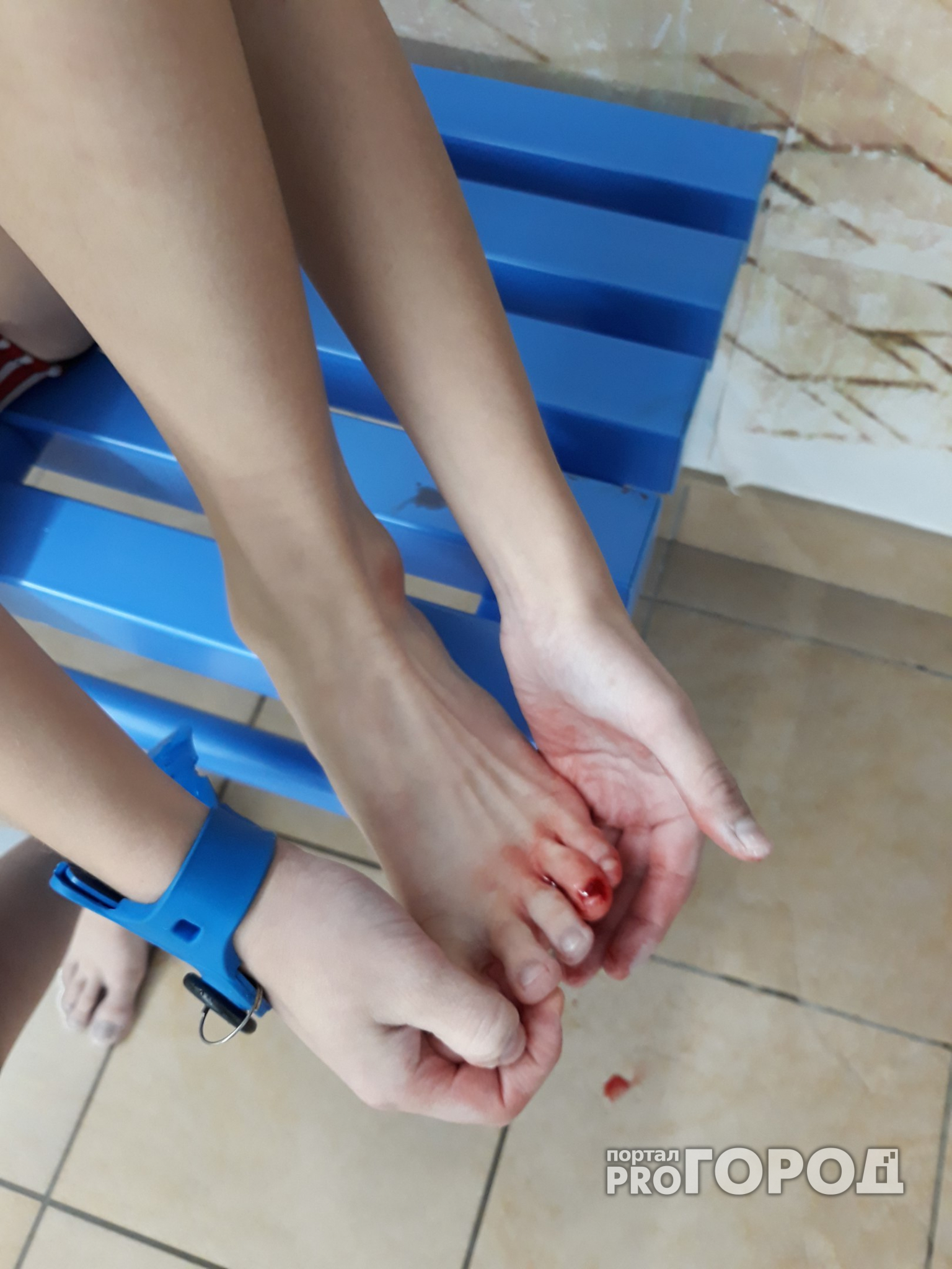 В Сыктывкаре плавание в бассейне закончилось кровотечением (фото)