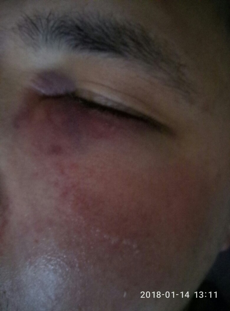Сыктывкарка: «Охрана клуба избила моего брата!» (фото)