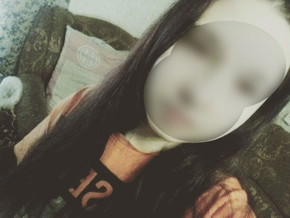 18-летняя сыктывкарка в подробностях рассказала, как ее сбил «Шевроле»