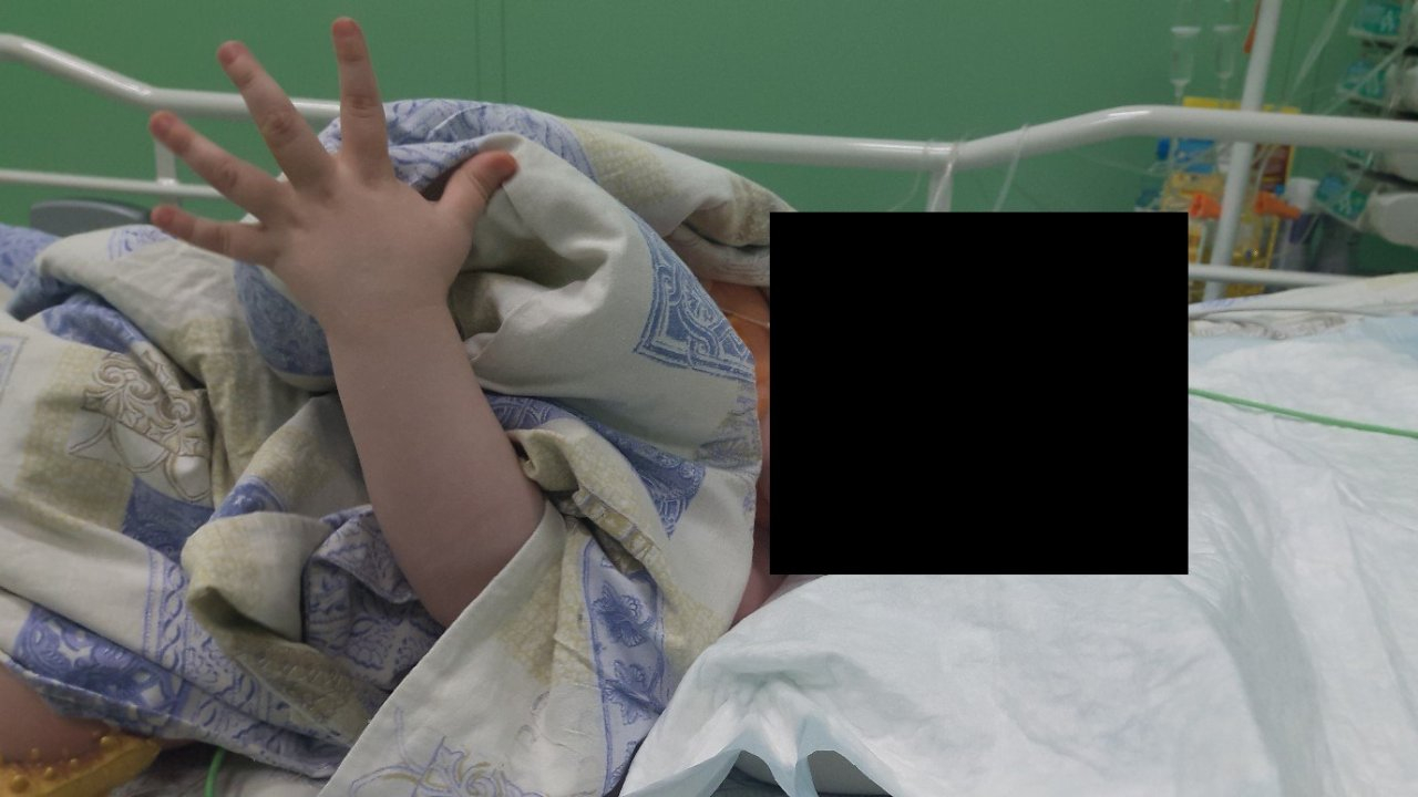 В Сыктывкаре ребенок попал в реанимацию с ожогом пищевода