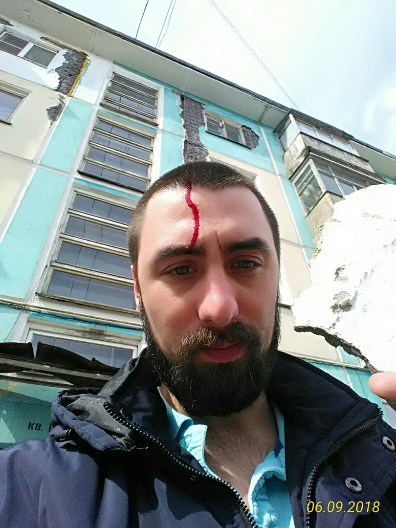 В Коми мужчине разбил голову камень, упавший с дома (фото)