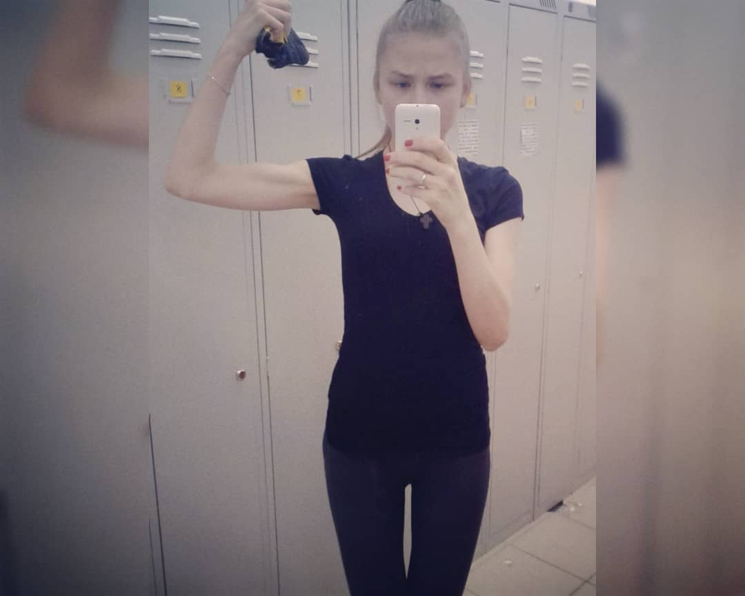 Проблемы с головой и палата в «психушке»: сыктывкарка рассказала о том, как она была анорексичкой