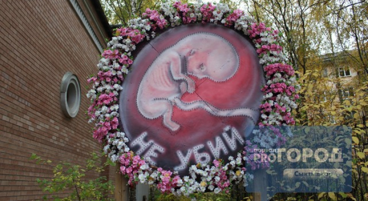 В России предложили признать эмбрион человеком: что говорят сыктывкарские гинекологи и церковь