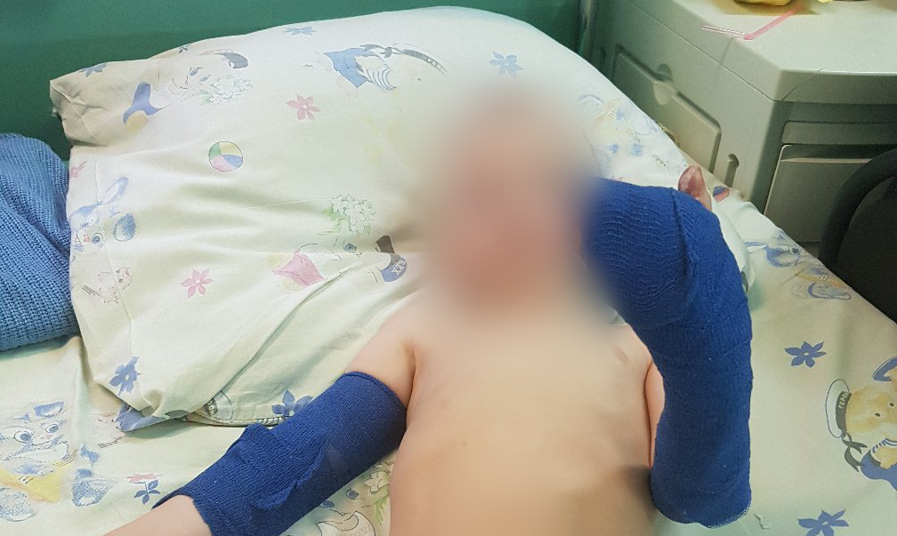 Сыктывкарка: «Мой сын лишился фаланги пальца в детском саду»