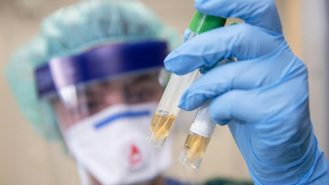 В Коми подтвердился еще 31 случай заражения коронавирусом