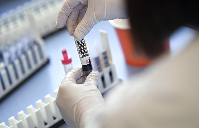 В Коми подтверждены еще 15 случаев заражения коронавирусом