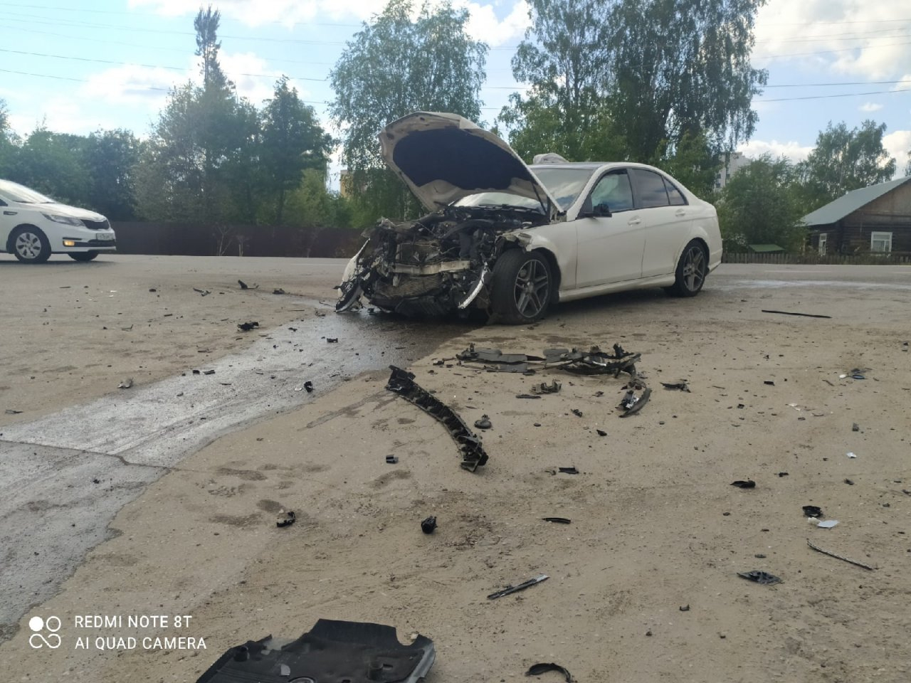 Стало известно состояние пострадавших в жуткой аварии на Сысольском шоссе в Сыктывкаре