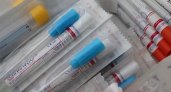 Роспотребнадзор напомнил, что важно перед сдачей ПЦР-теста