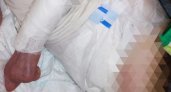 Волонтеры рассказали, что сыктывкарку выписали из больницы с множеством пролежней