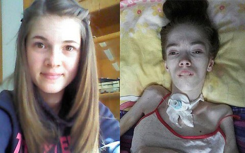 Парень жестоко избил девушку за переписку в соцсетях: 19-летнюю Веронику парализовало