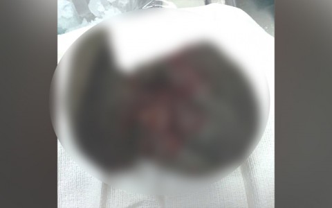 Отец шокировал Сеть фотографией печени своей полуторогодовалой дочери