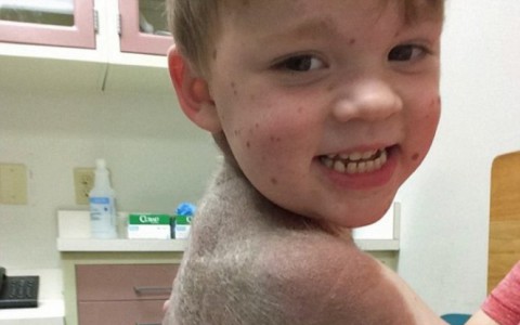 4-летний мальчик прошел через 26 увеличений груди