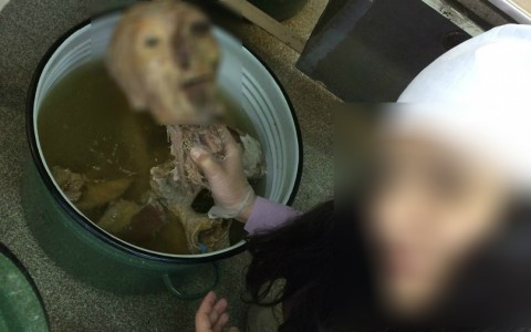 Сыктывкарцы о медике, которая выложила в сеть фото с человеческой головой: «Дура она»