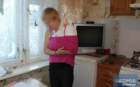 Минздрав Коми прокомментировал случай, когда пациентку с переломом месяц лечили от болезни суставов