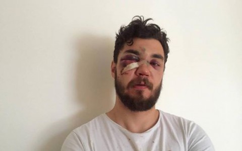 Мужчину избили за то, что он снял с авто бумажку, скрывающую номер