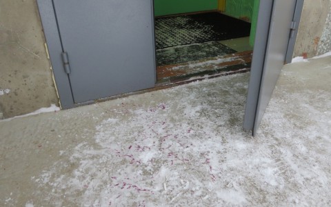В детсаду прокомментировали случай, когда сыктывкарке дверь отрубила палец (фото, видео)