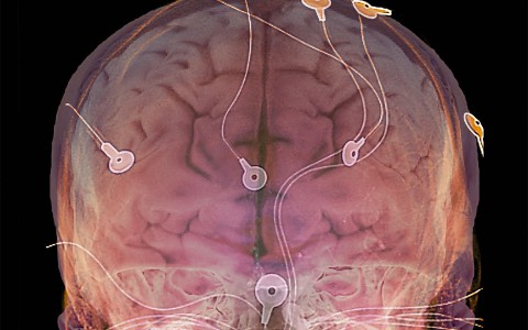 Учёные выяснили, что происходит с мозгом после смерти