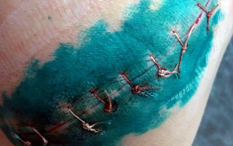 В Коми девочке наложили восемь швов после катания на горке (фото)