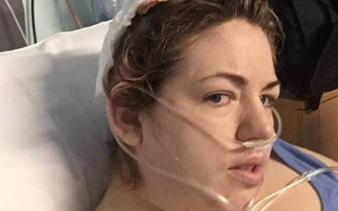 Женщина покрасила волосы дома и осталась без скальпа