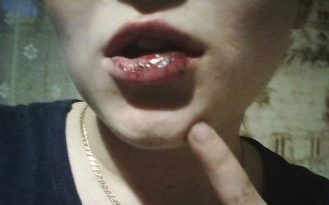 В Сыктывкаре пьяный мужчина жестоко избил 16-летнюю девушку (фото)