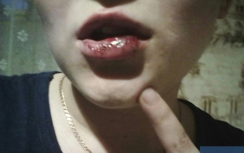 В полиции прокомментировали жестокое избиение 16-летней сыктывкарки