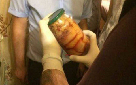 Стало известно, чье мясо хранилось в холодильнике «краснодарских каннибалов»