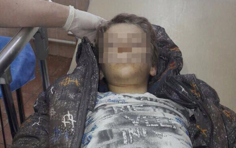 Паника в соцсетях: в Сыктывкаре в больницу попал мальчик без сознания