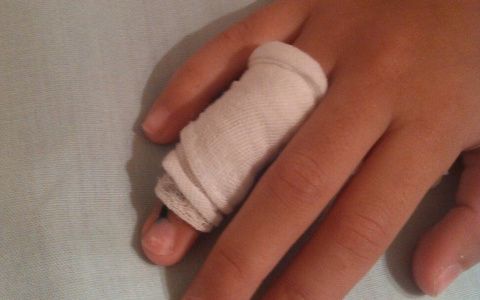 В сыктывкарском Лесозаводе на маленькую девочку напала бродячая собака (фото)