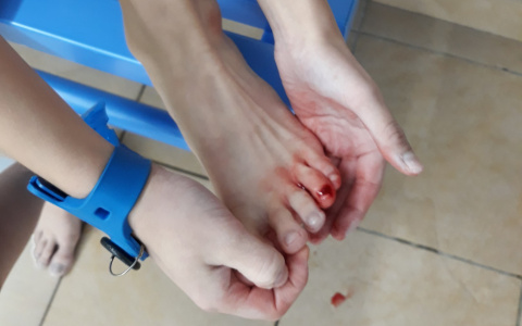 В Сыктывкаре плавание в бассейне закончилось кровотечением (фото)