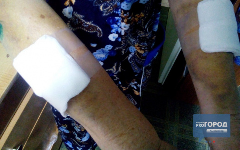 В Коми разъяренная стая бродячих собак набросилась на пенсионерку (фото)