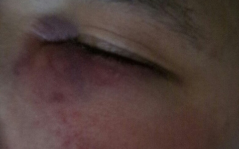 Сыктывкарка: «Охрана клуба избила моего брата!» (фото)