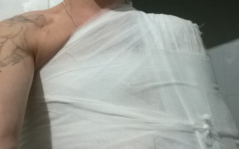 Сыктывкарец получил серьезную травму из-за того, что на дороге не убрали снег