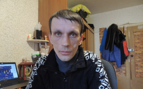 Мужчина из Коми, который сбежал из рабства, не будет обращаться в полицию