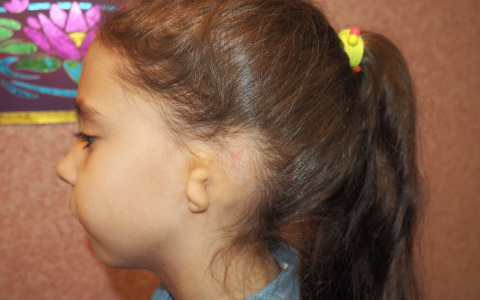 Сыктывкарец пожертвовал девочке с редкой аномалией в развитии 170 тысяч