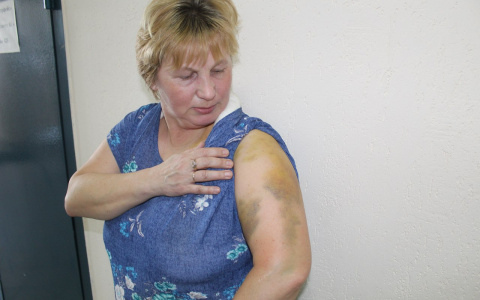 В Сыктывкаре на женщину с крыши дома упала глыба льда