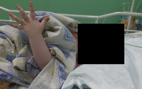 В Сыктывкаре ребенок попал в реанимацию с ожогом пищевода