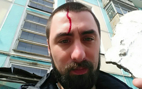 В Коми мужчине разбил голову камень, упавший с дома (фото)